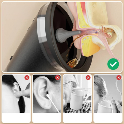 Electronic Ear Cleaner for Removing Earwax