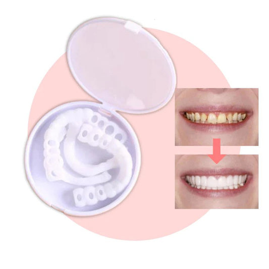 Facette Dentaire Instantanée pour Sourire Naturel - Foivo